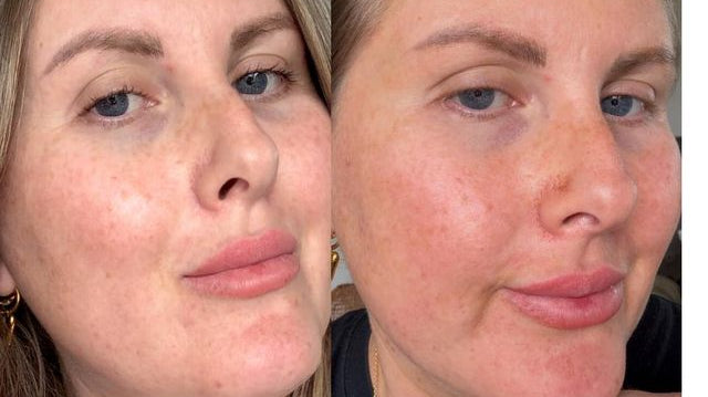 The Face Tan Serum Everyone’s Talking About in NZ