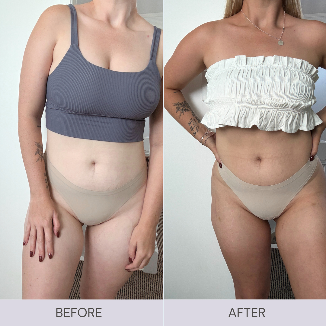 Before and after comparison of a person before self tan and after self tan.