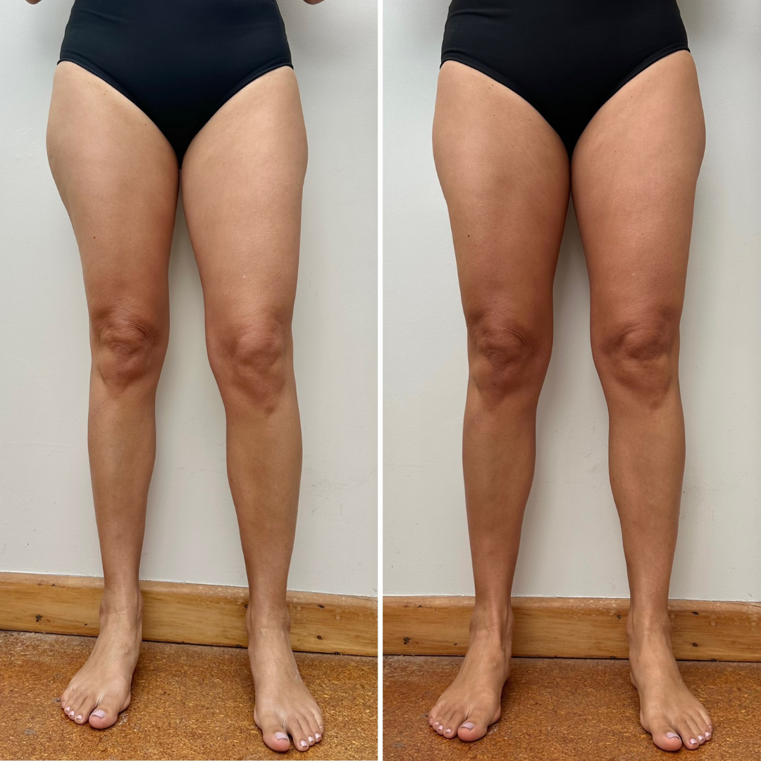 Best gradual tan moisturiser for face – Byremi product demo