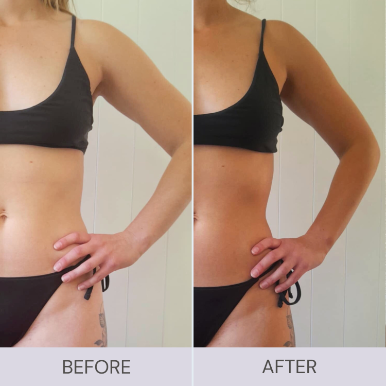 before and after ultra dark tanning mousse