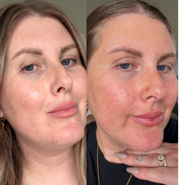 Byremi dark face tan with rich bronze finish