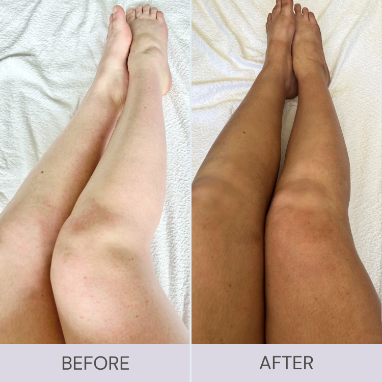 self tanning before and after legs