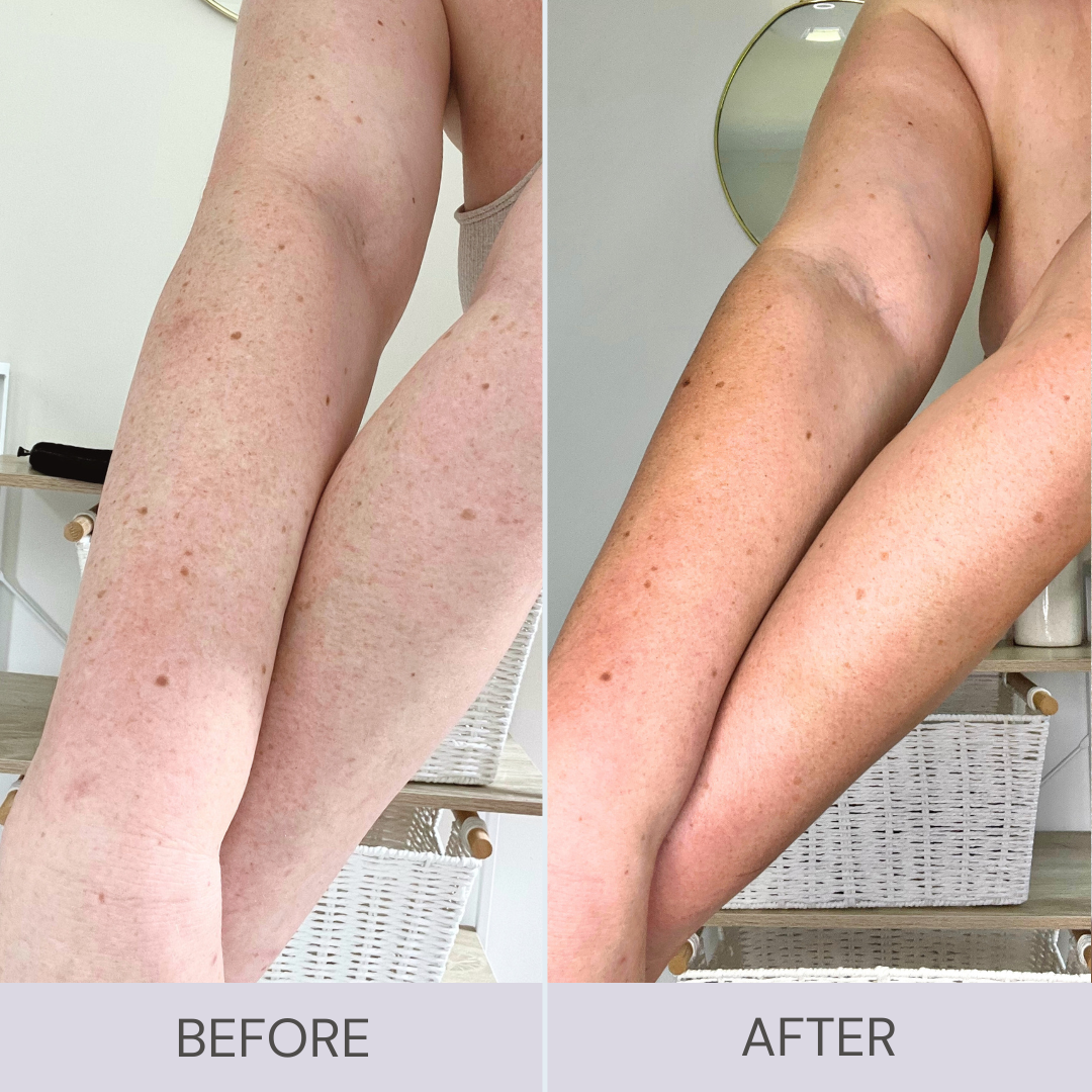 Before and after using Byremi ultra dark self tanner