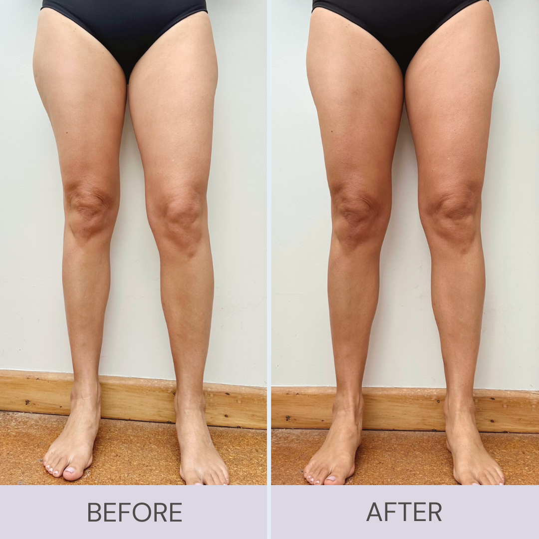 Before and after using Byremi ultra dark self tanner