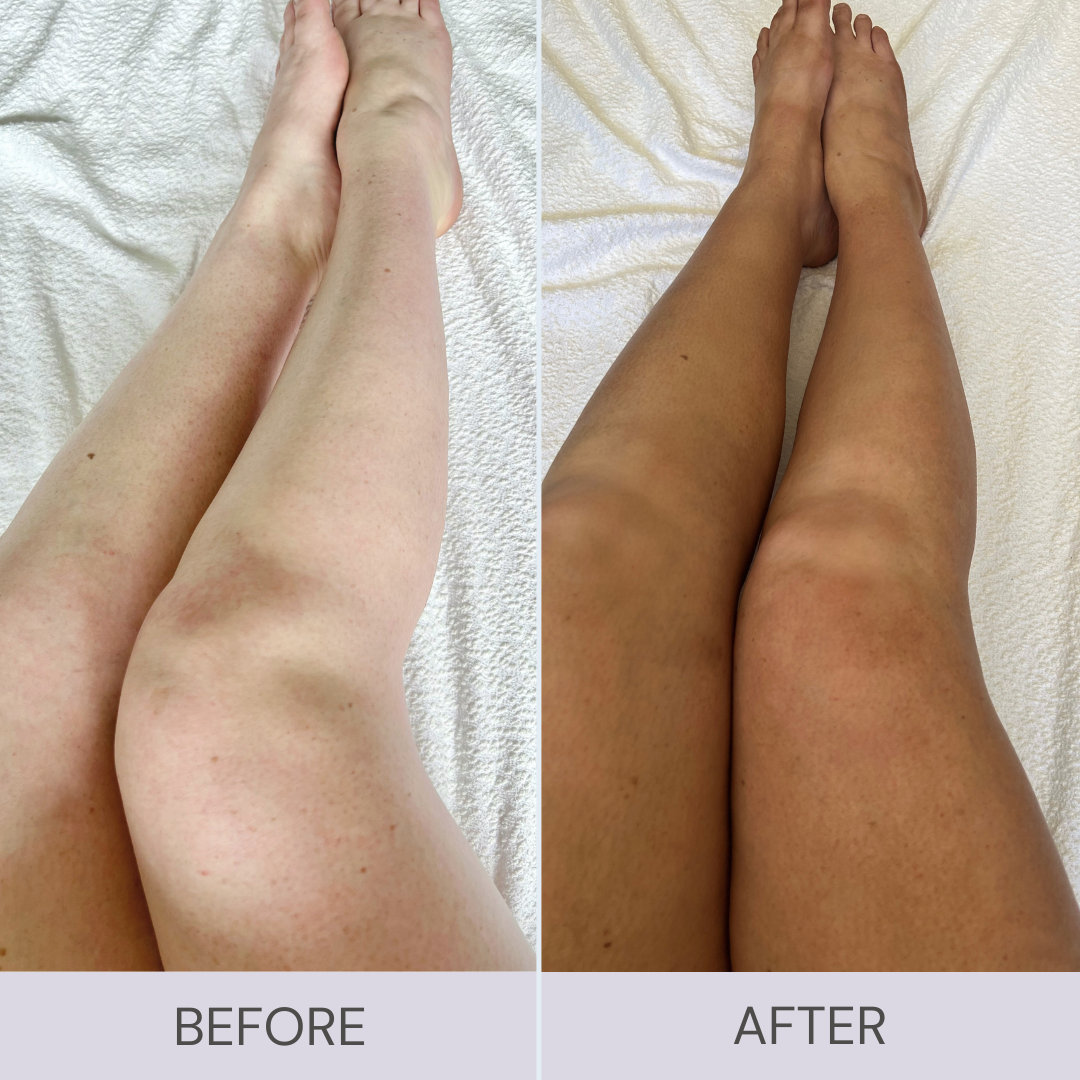 before and after ultra dark self tan results ugc 