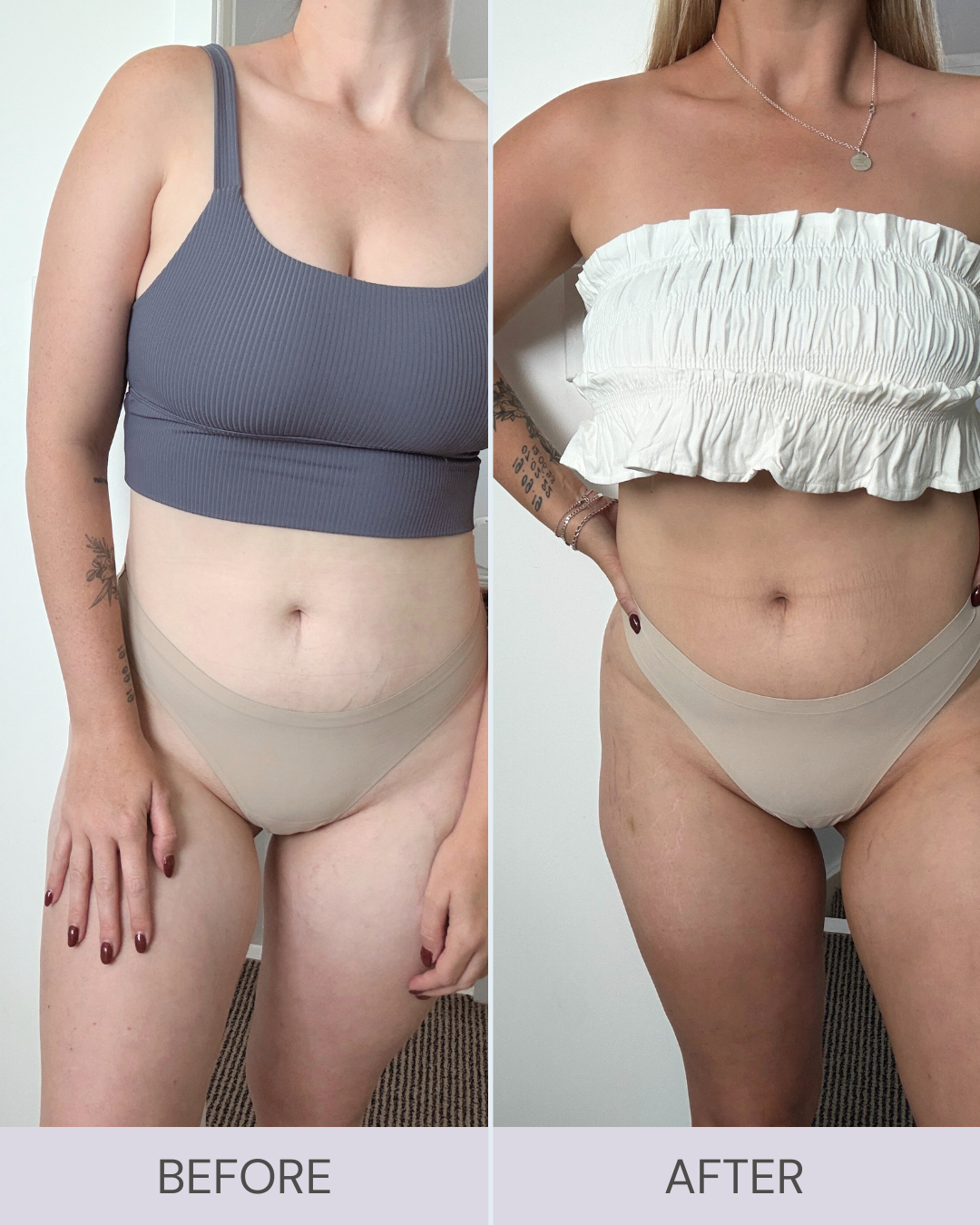 medium dark before and after results (6).png